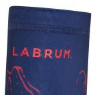 Labrum Sleeve 3